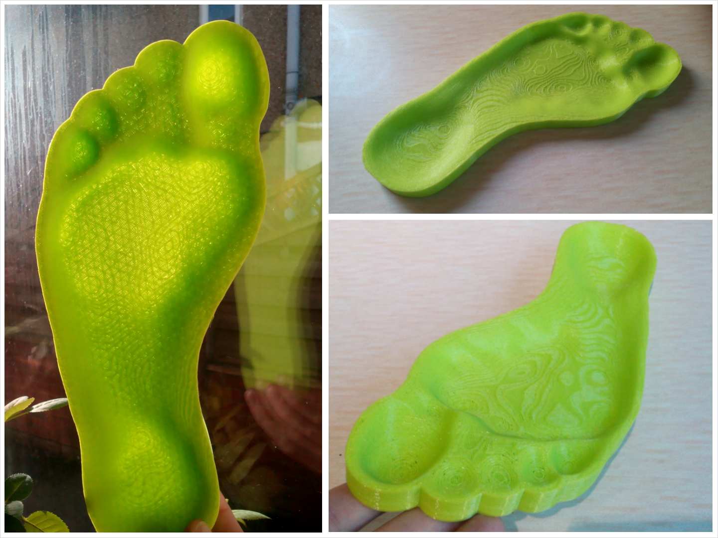 Form Fitting Insole