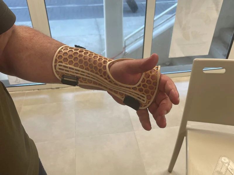 Parametric wrist orthesis