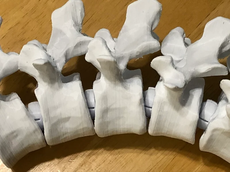 Articulating Lumbar Vertebrae