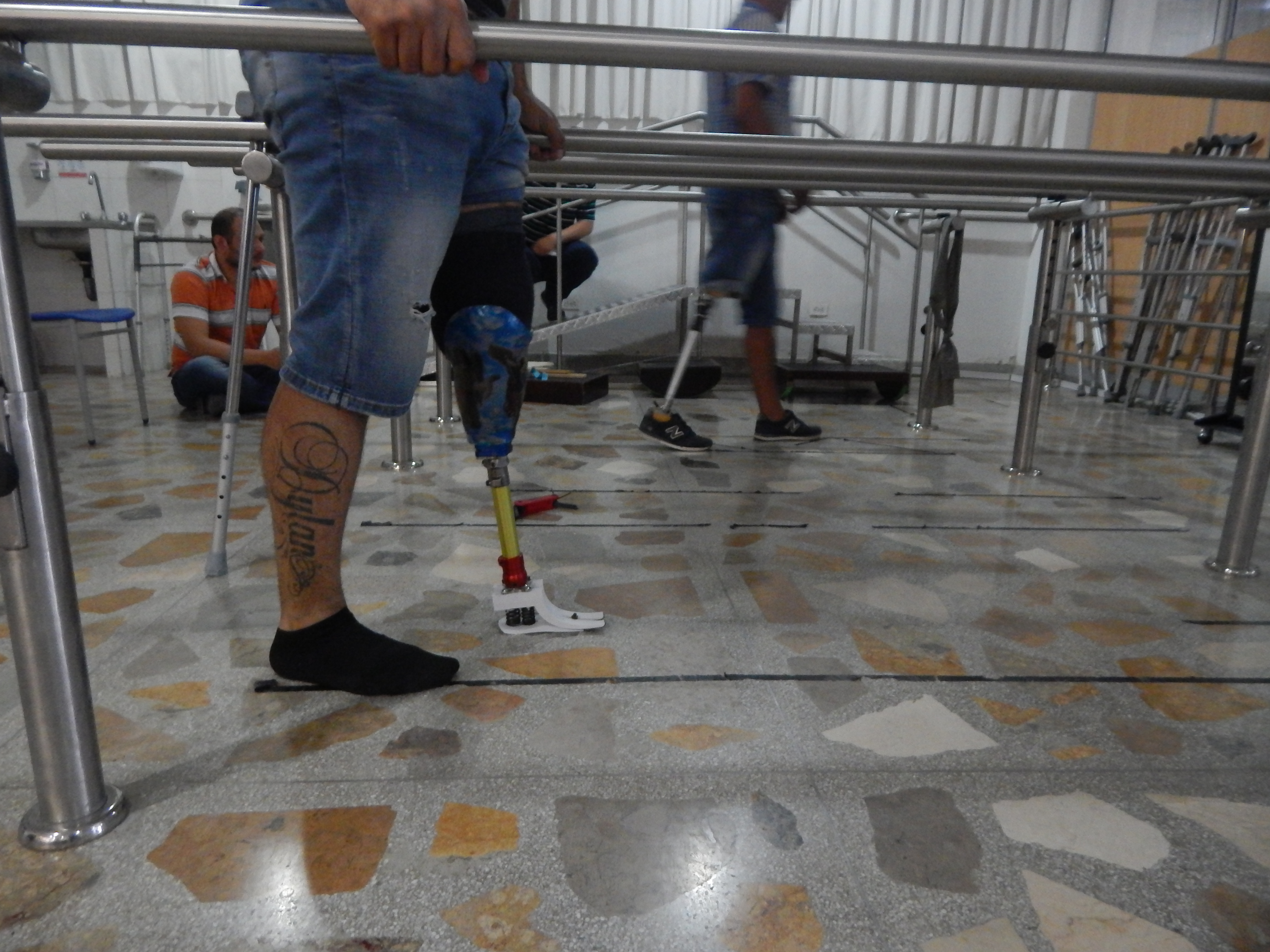 3D Prosthetic foot
