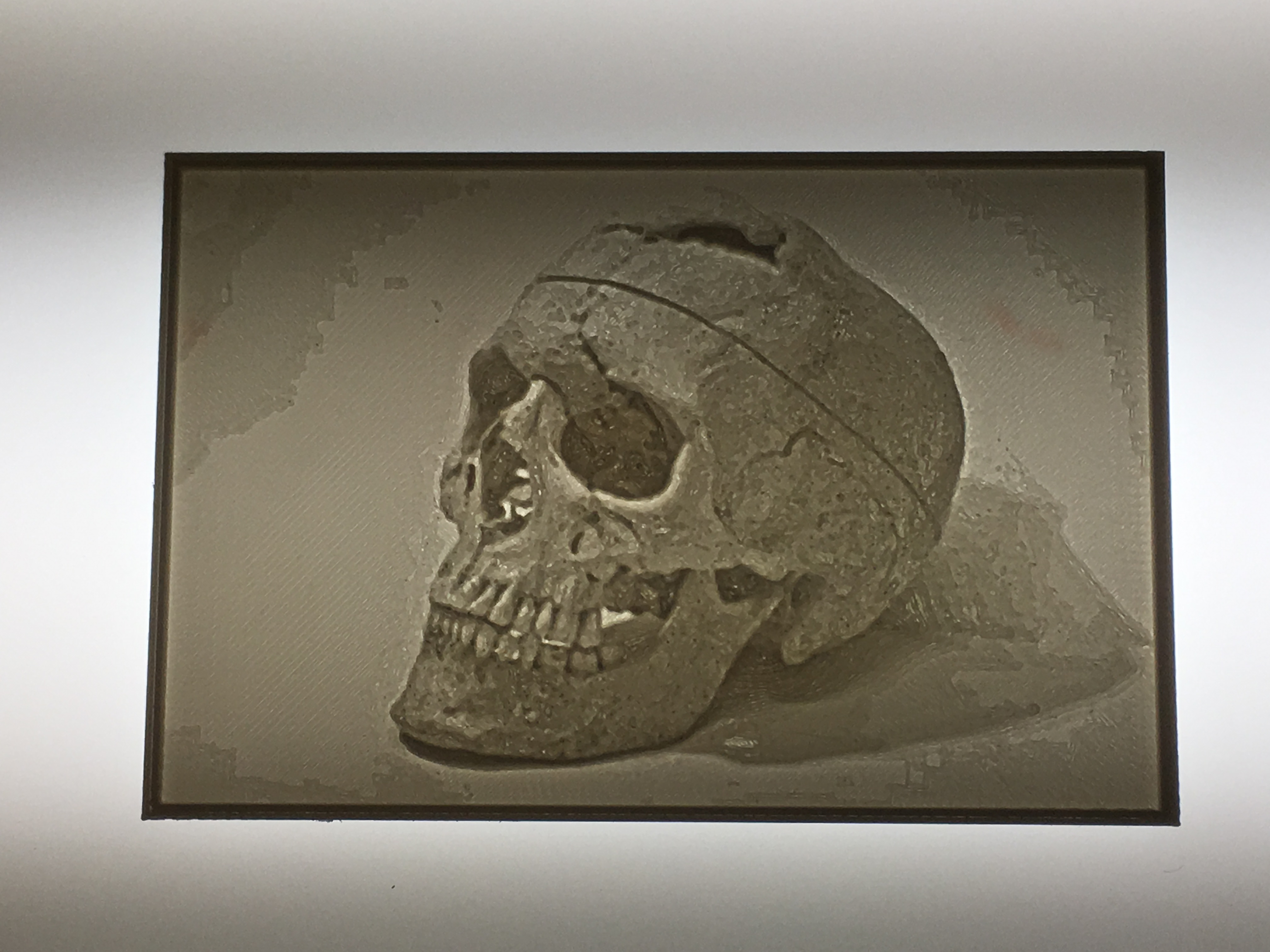 Phineas Gage Skull- Lithopane