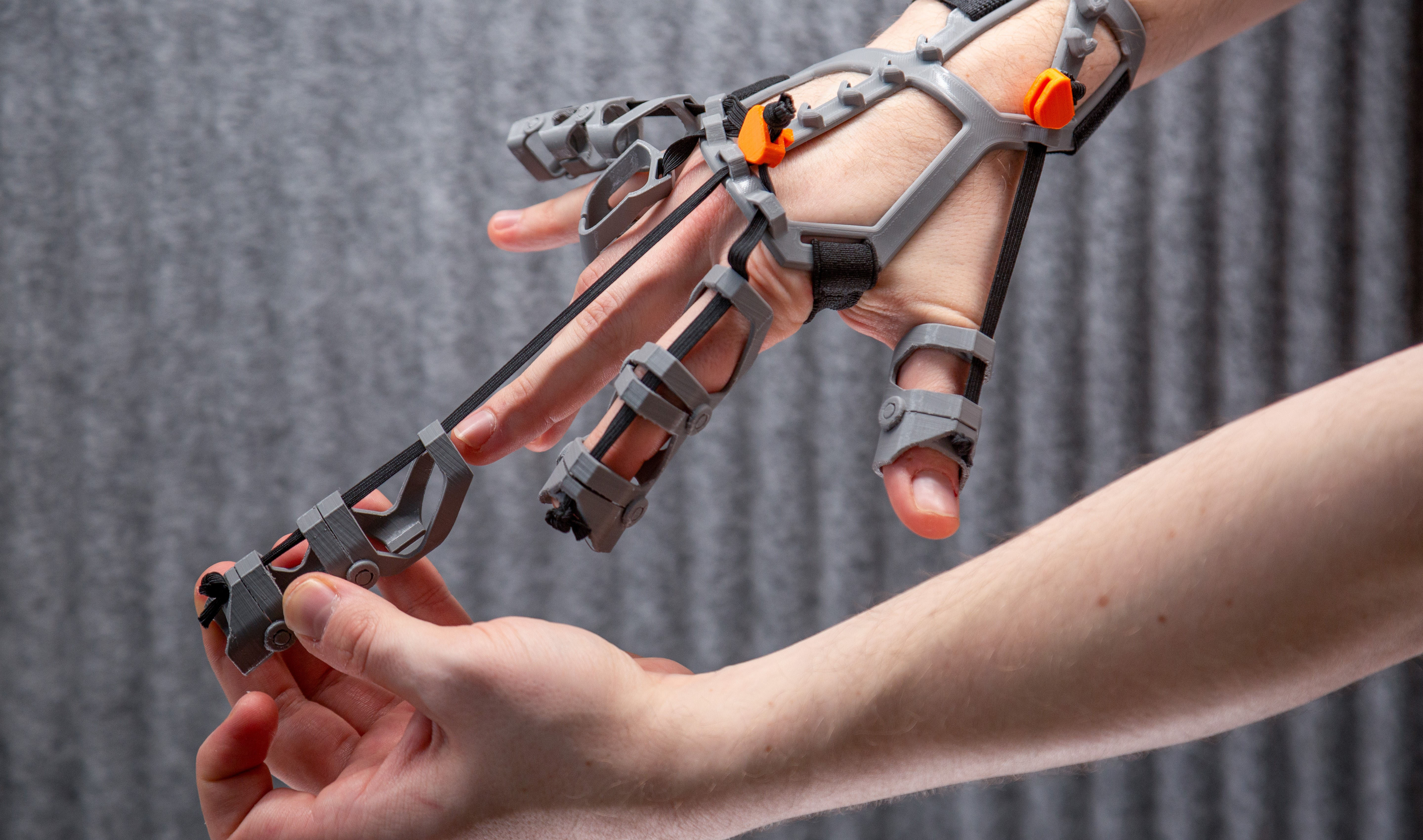 Improving fine motor skills, designing a 3D FDM printed orthosis to assist in the rehabilitation of individuals with hand spasticity