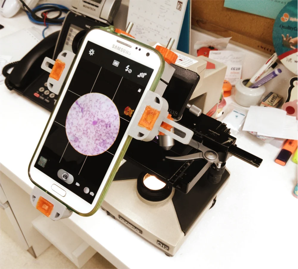 Universal Smart Phone Microscope Mount Remix
