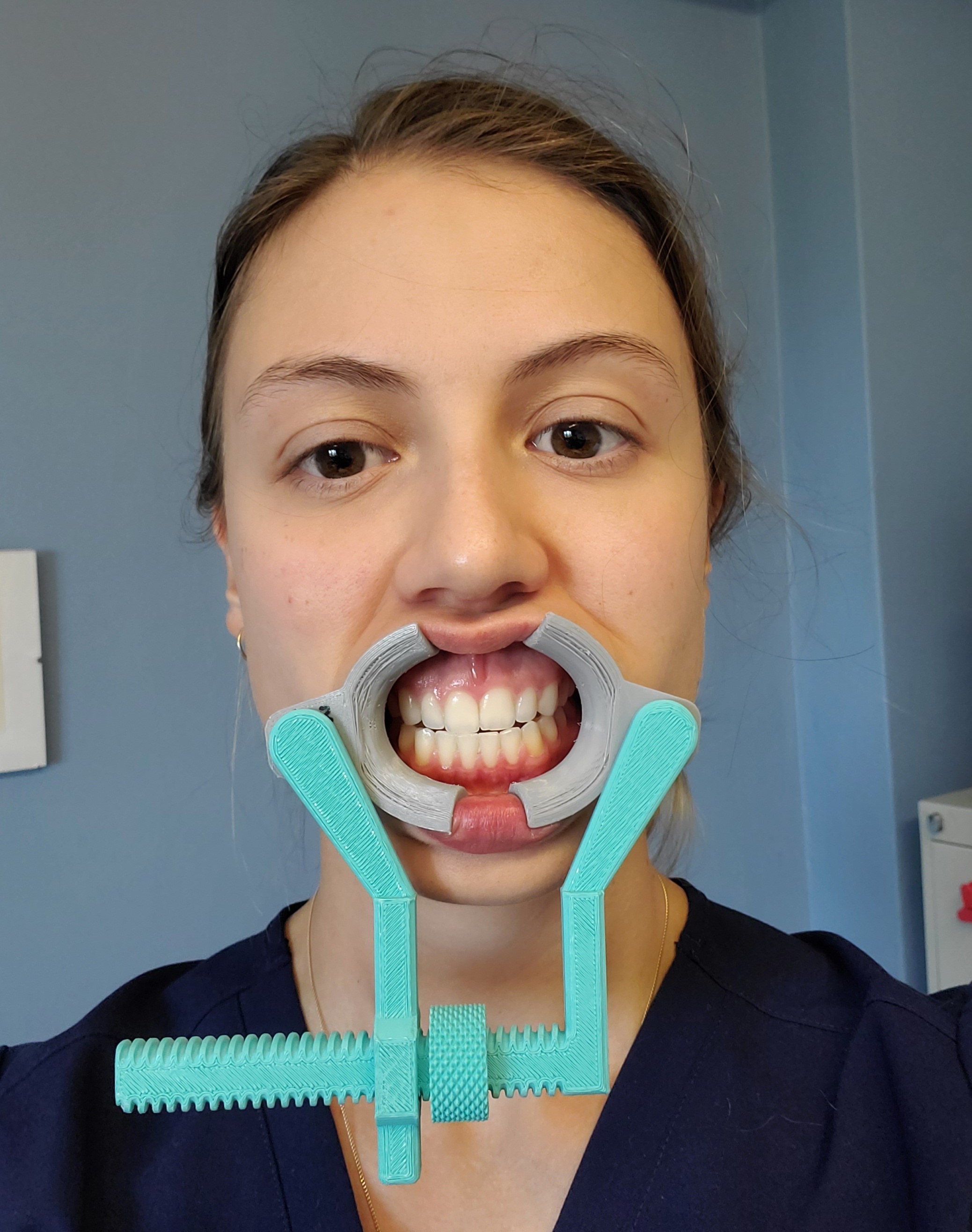 Microstomia Orthosis/Splint + Adjustments