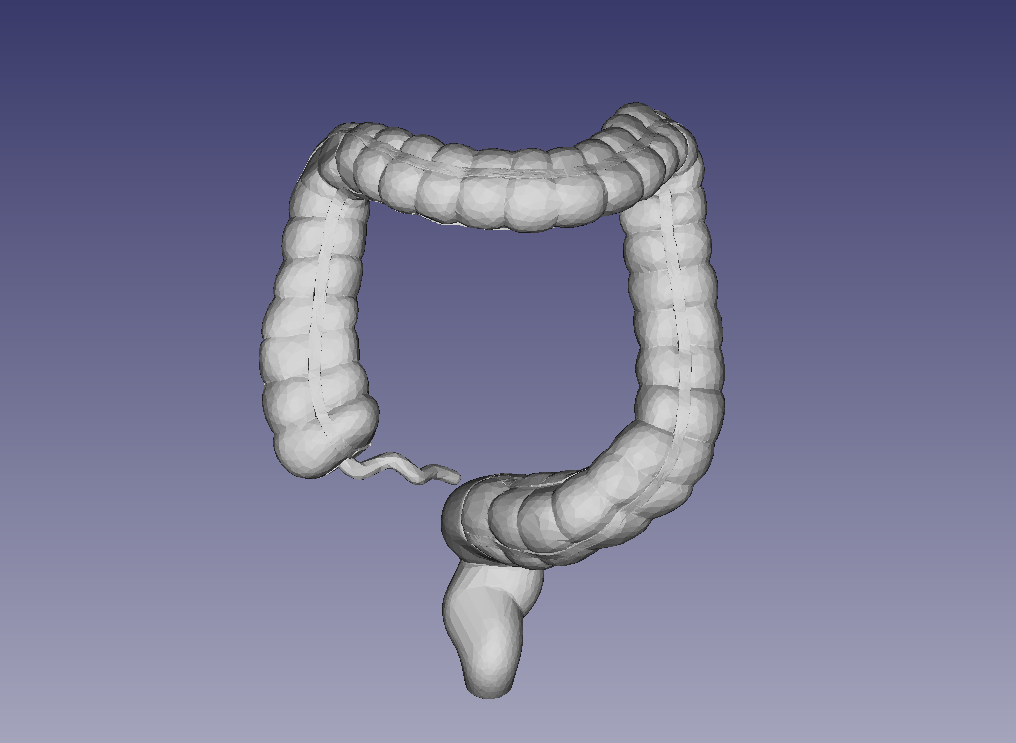 large colon