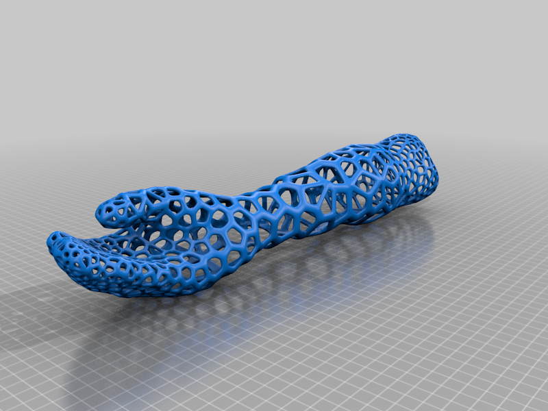 Prosthetic Arm