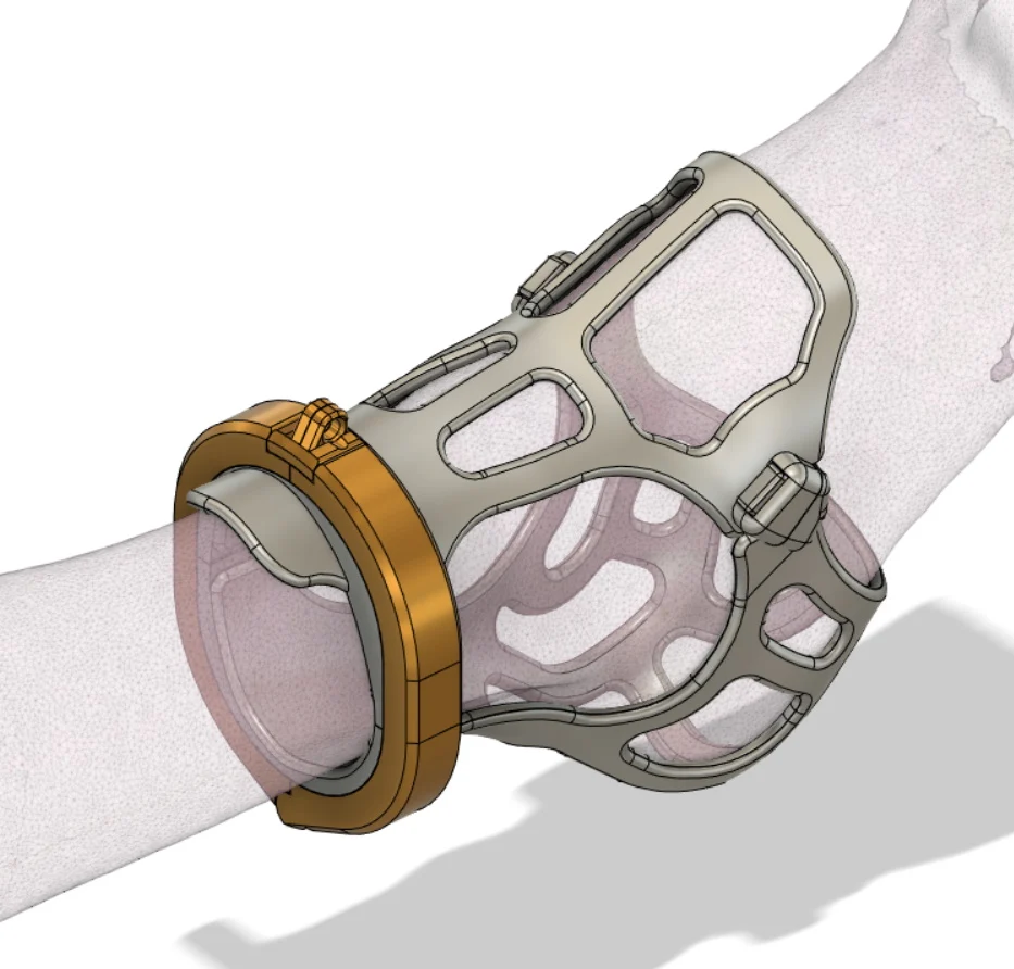 Ankle Cage