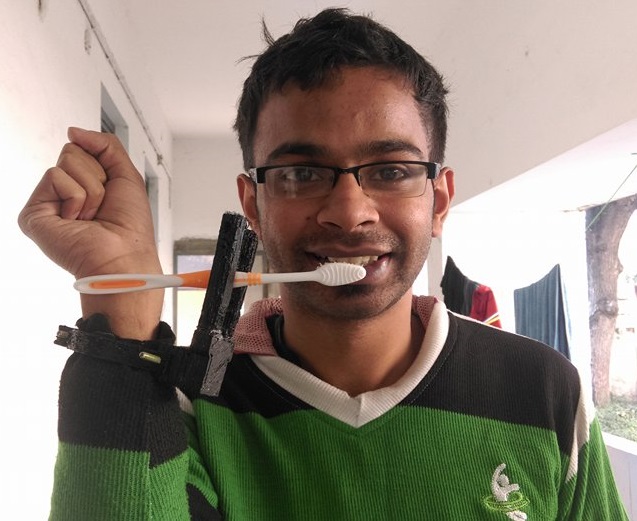 Affordable Prosthetic for people without Fingers