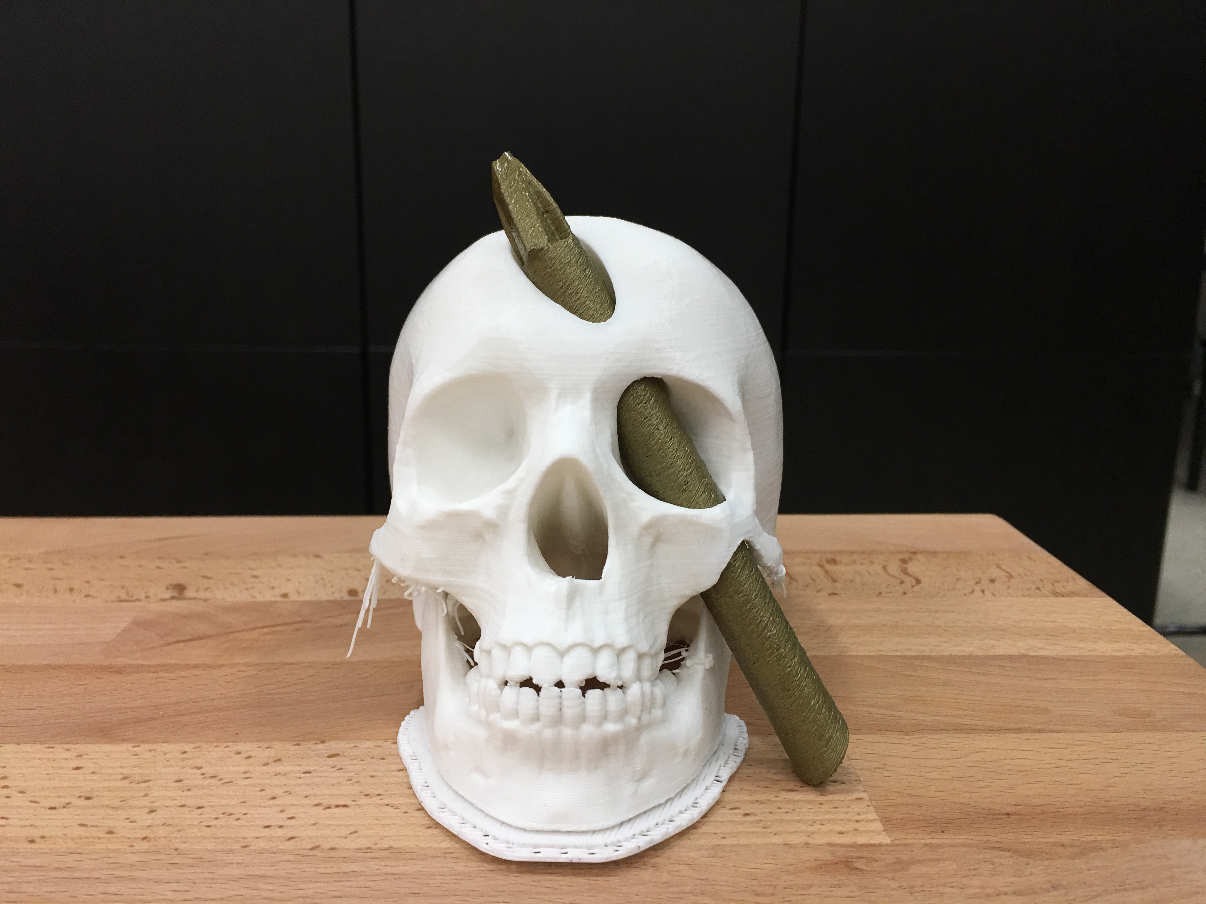 Phineas Gage Skull