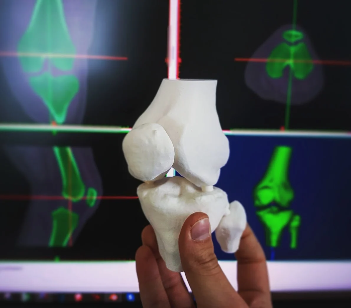Knee (from CT scan)
