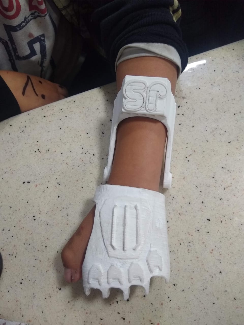 protesis para jhon sebastian
