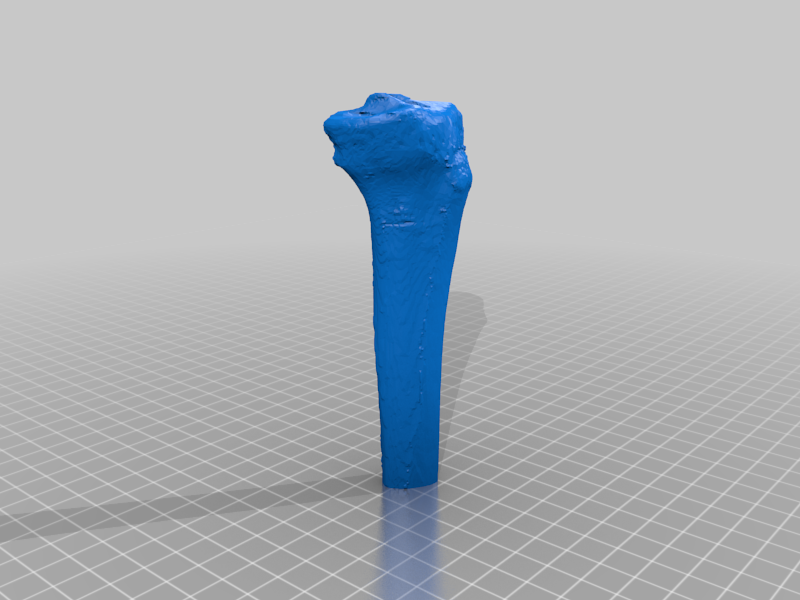 Tibia [ Human Tibia Bone in two parts ]
