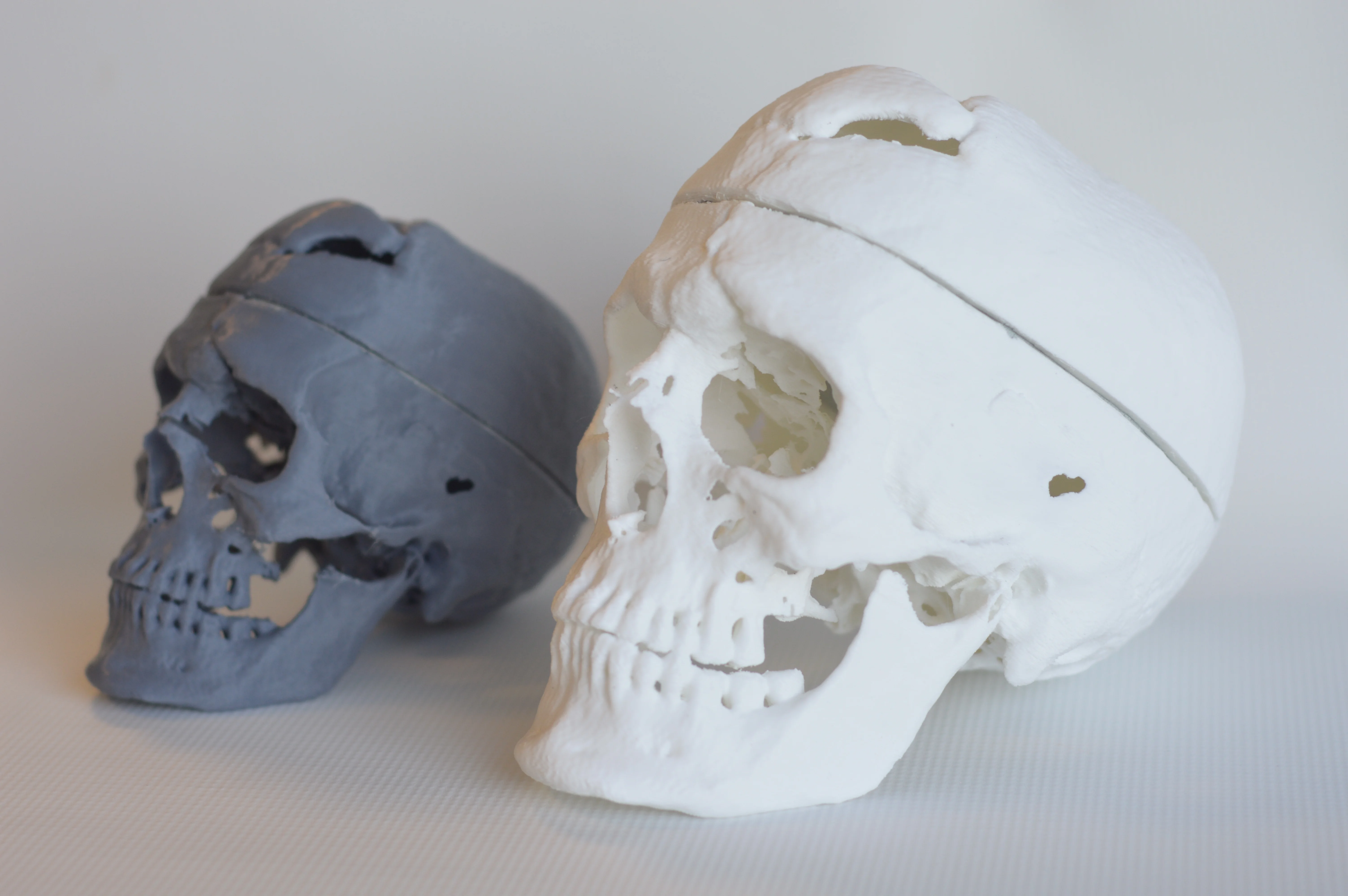 Skull of Phineas Gage
