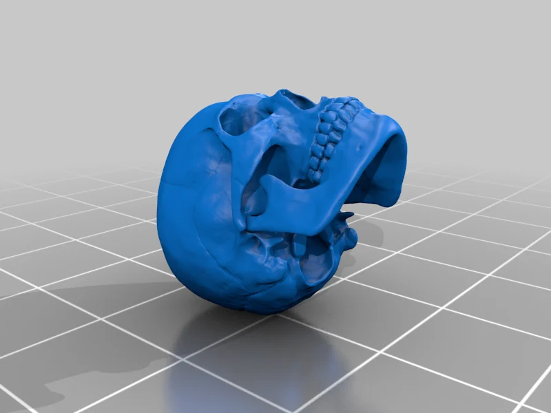Human skull