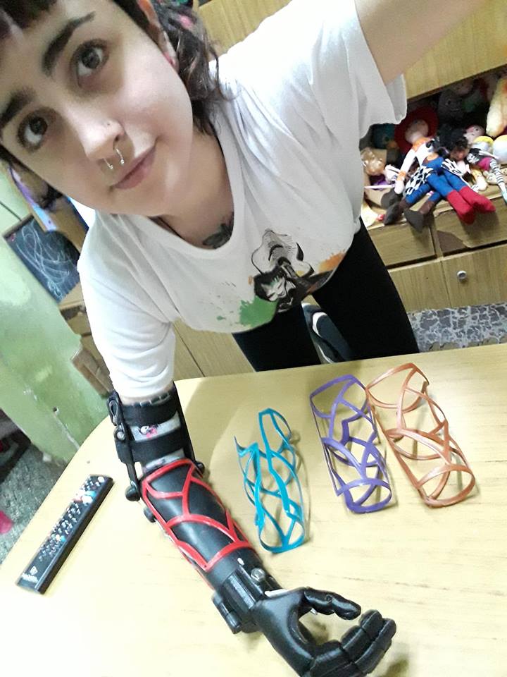Hope#1 prosthesis ARM based on flexy hand