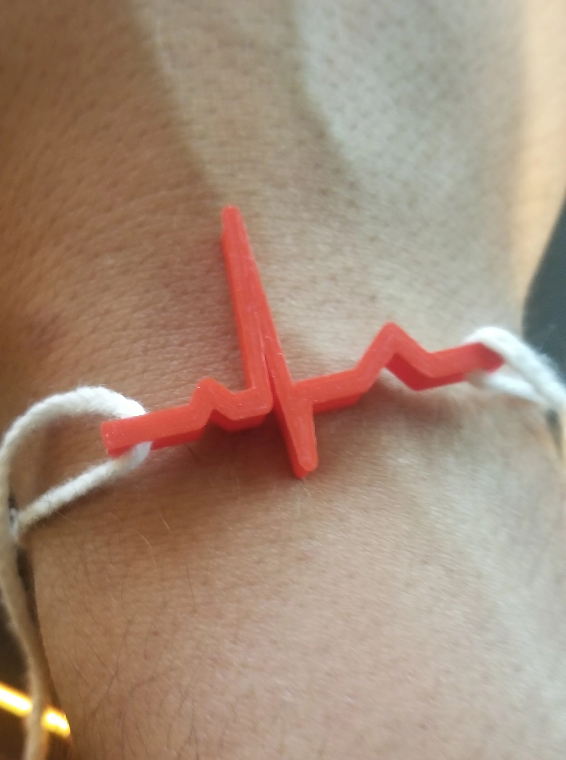 ECG Wave