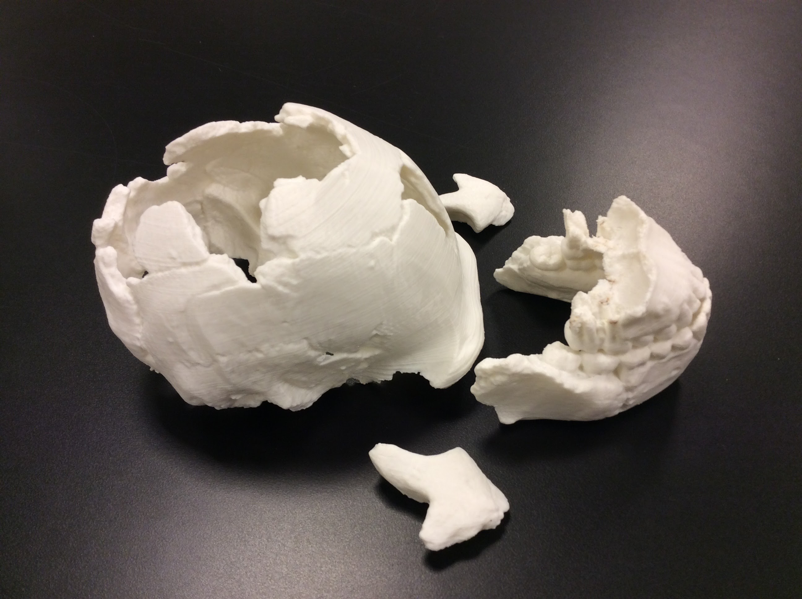 Homo Naledi Skull Reconstruction - Calvaria