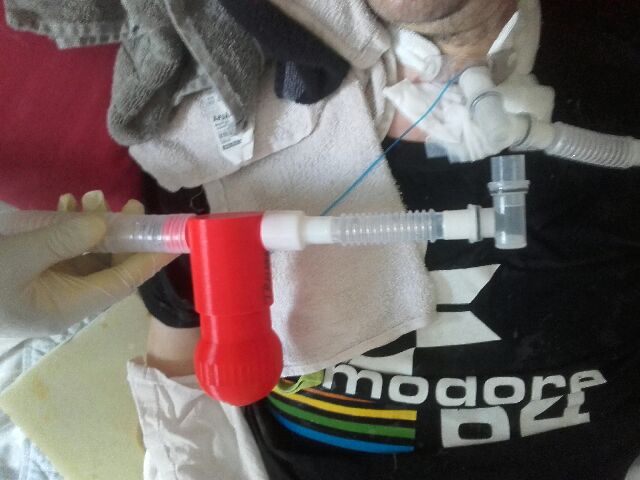 Mucus Separator