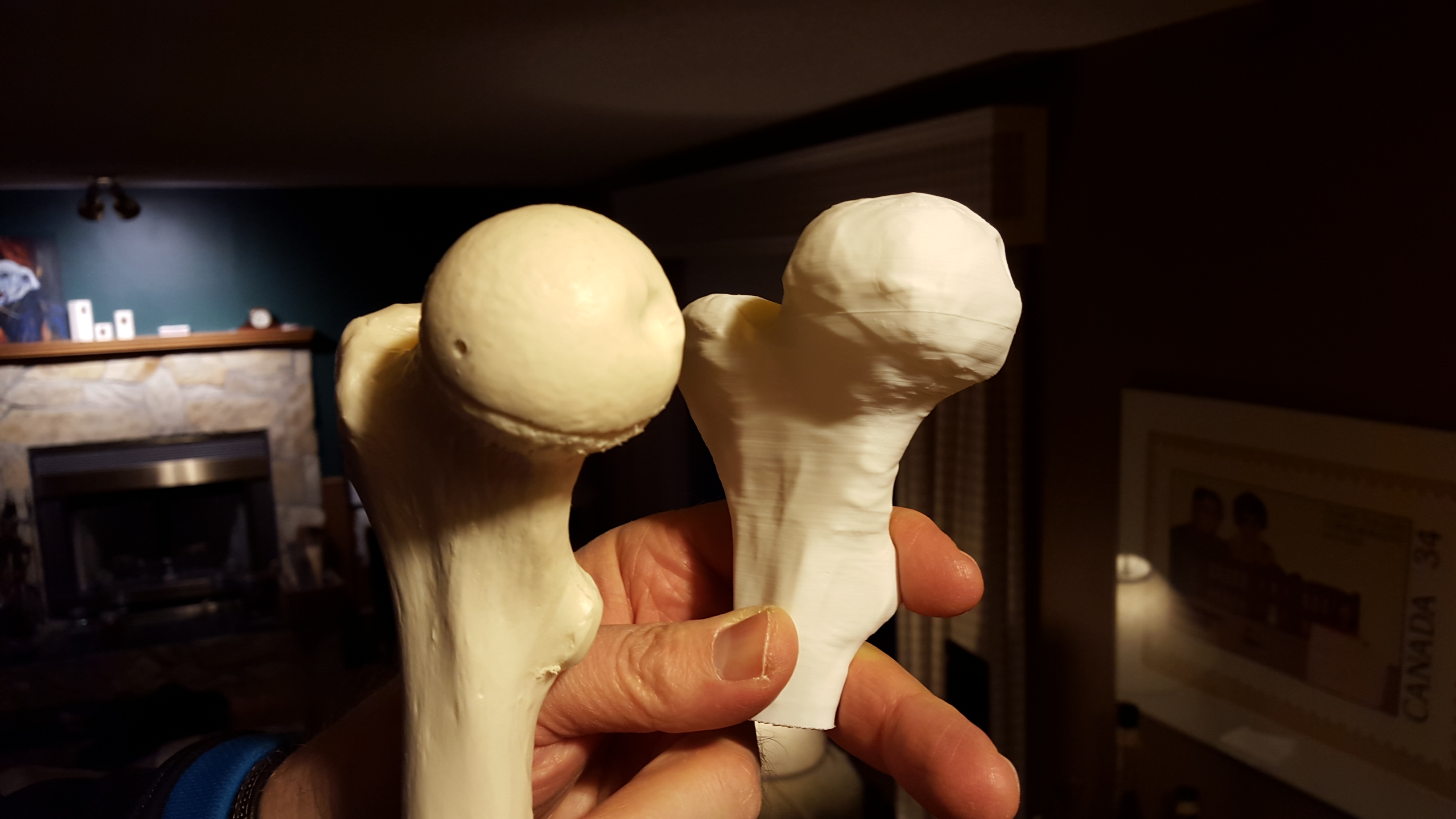 Alberta High School CTS - 3D Printed Bone Replacements
