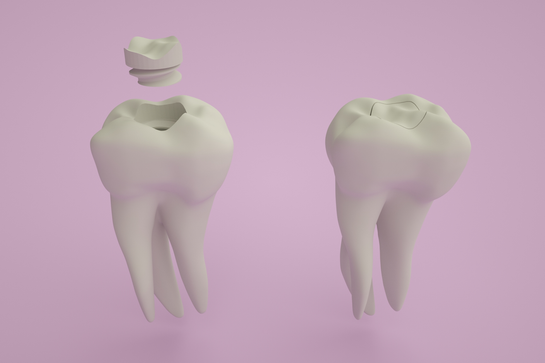 Tooth fairy box
