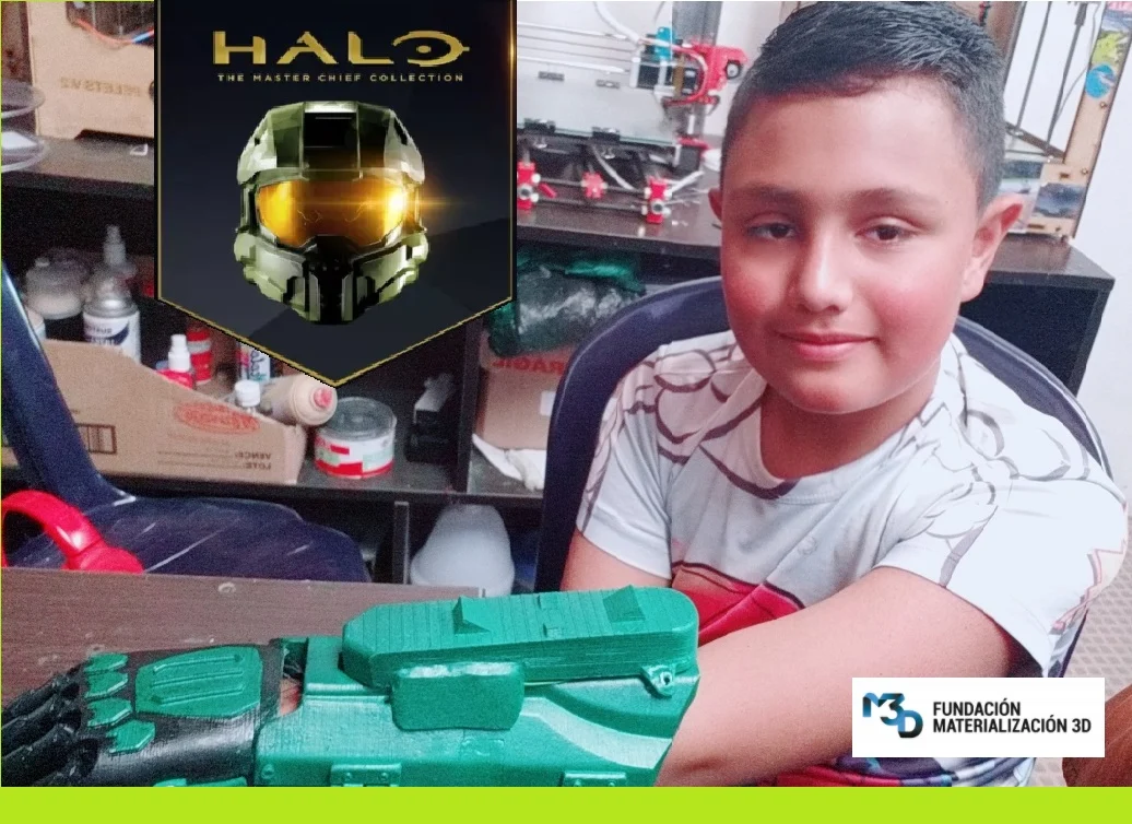 Protesis Halo Julian