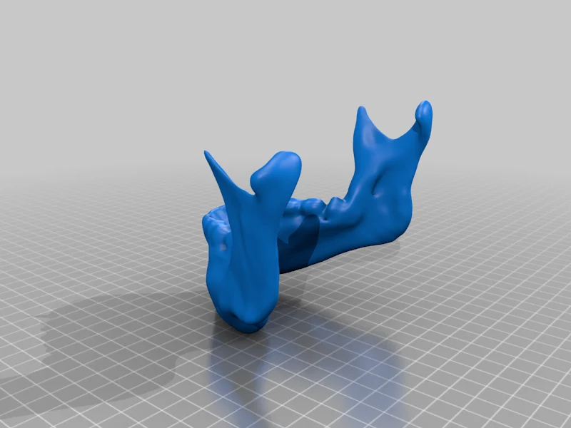 Mandible - Lower Jaw Bone