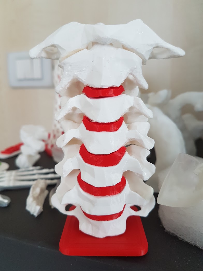 Cervical vertebrae