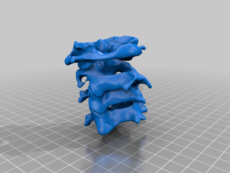 Cervical Vertebrae