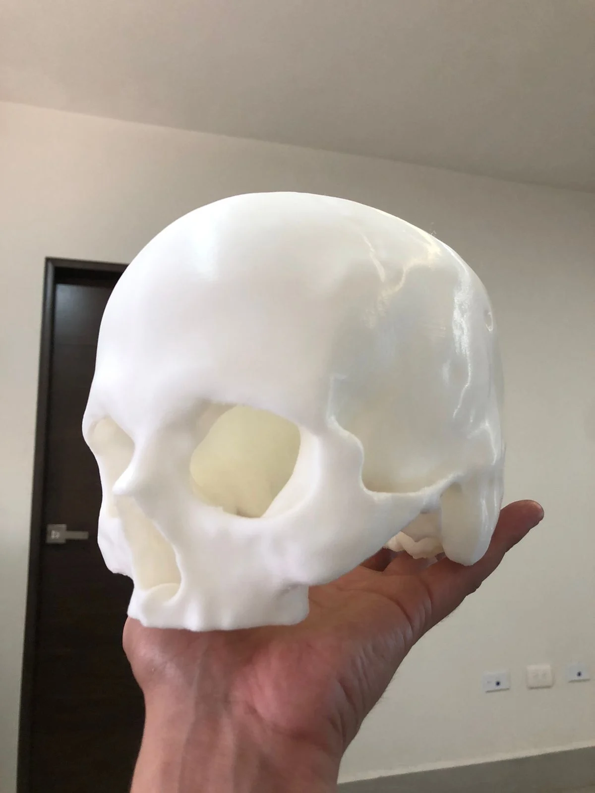 Craneo Anatomico Ed Solido
