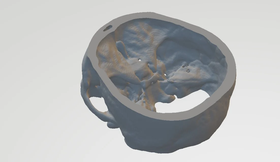 skull base