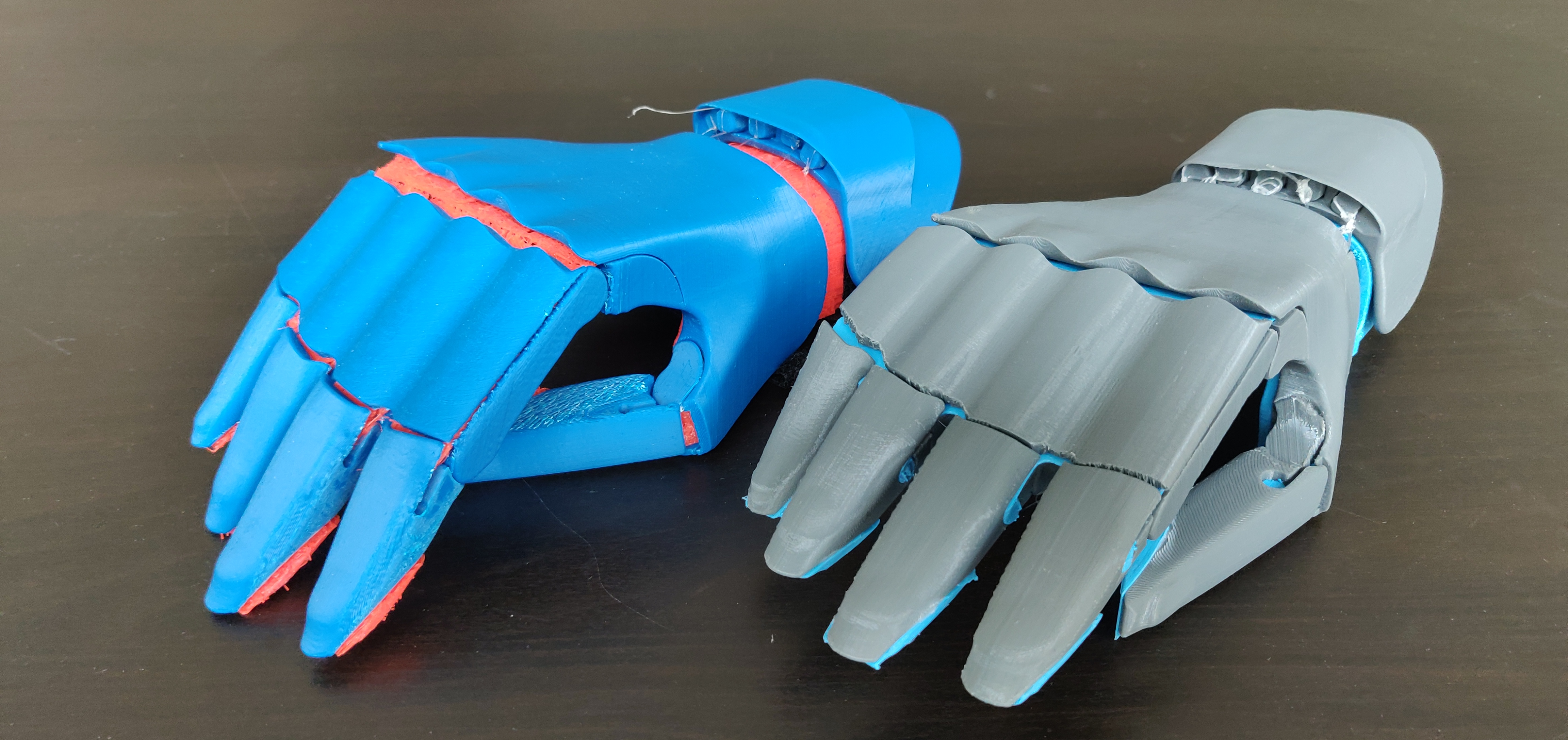 hand prosthesis SDC