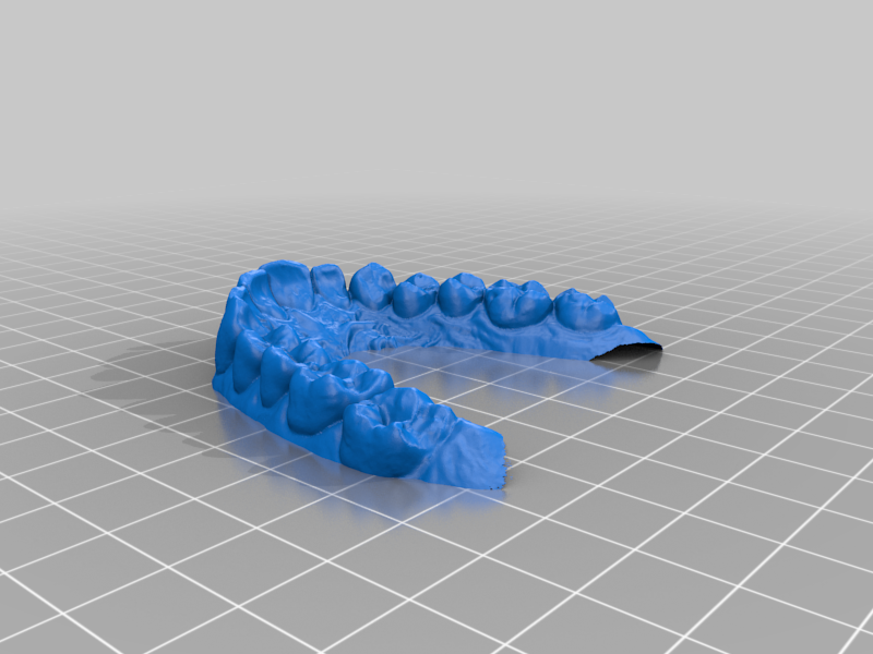 Scansione denti bocca (scan tooth mouth)