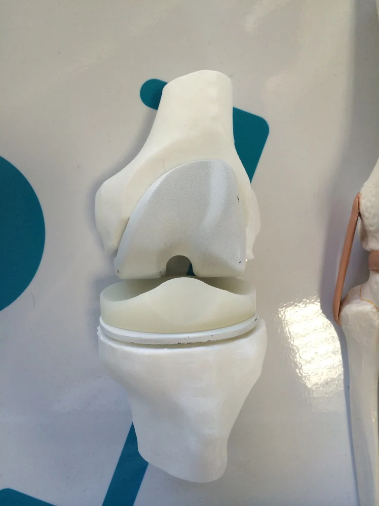 Knee prosthesis model
