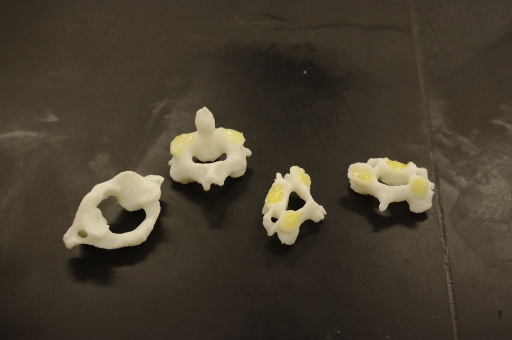 Human cervical vertebrae, C1-C4