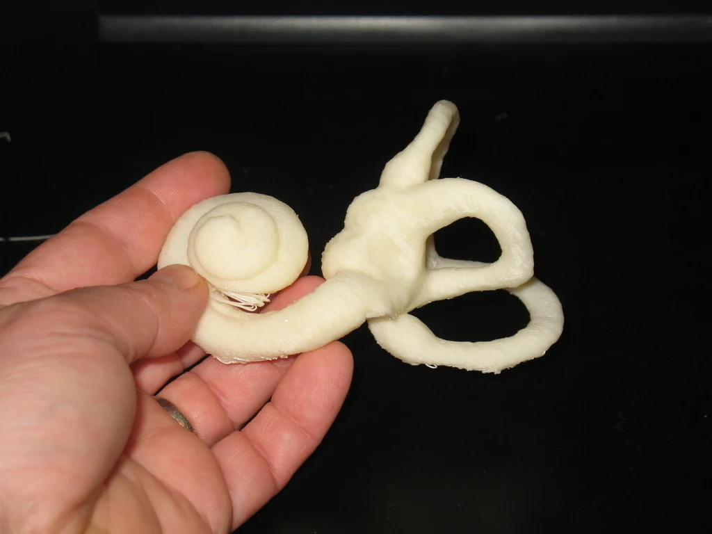 Human inner ear