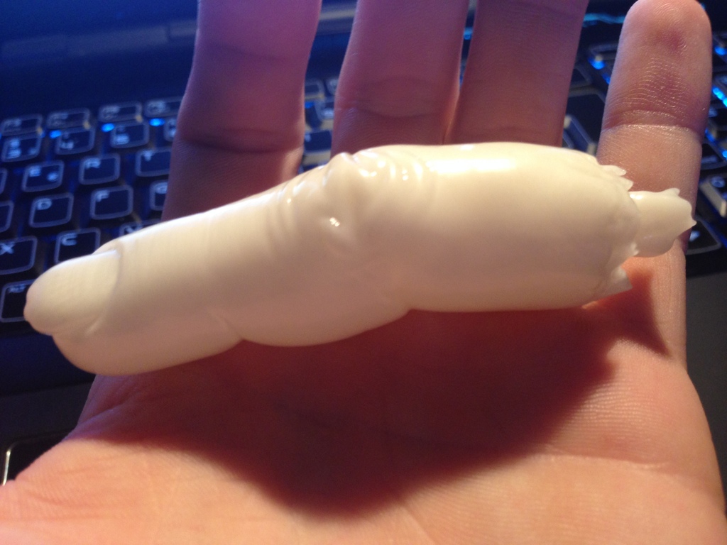 Finger
