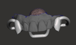 Retractable Vampire Teeth V2