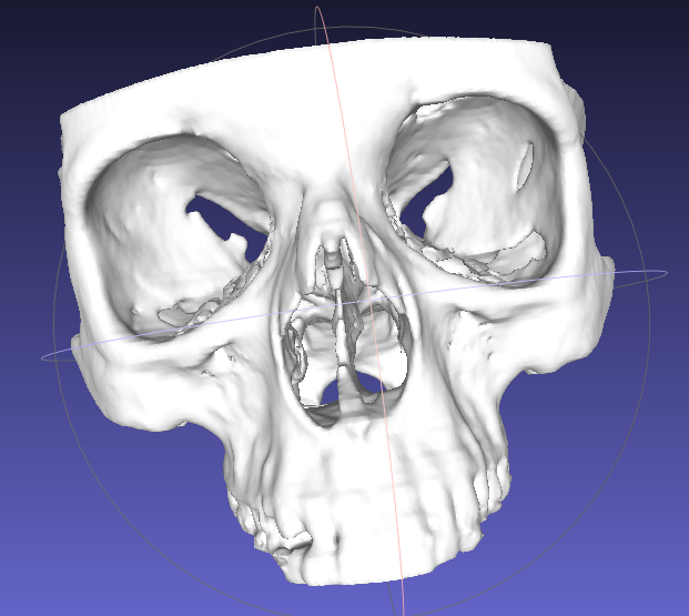 Medical Scans
