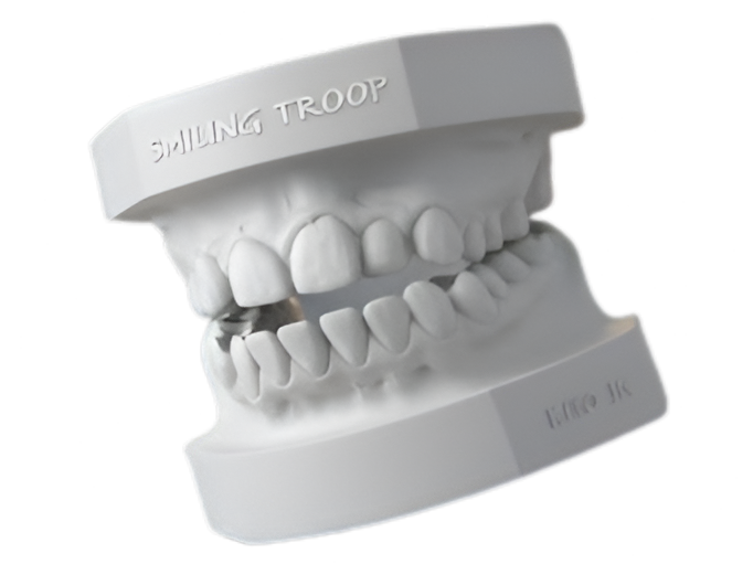 MODELO DENTAL SUPERIOR E INFERIOR ARTICULADO #1