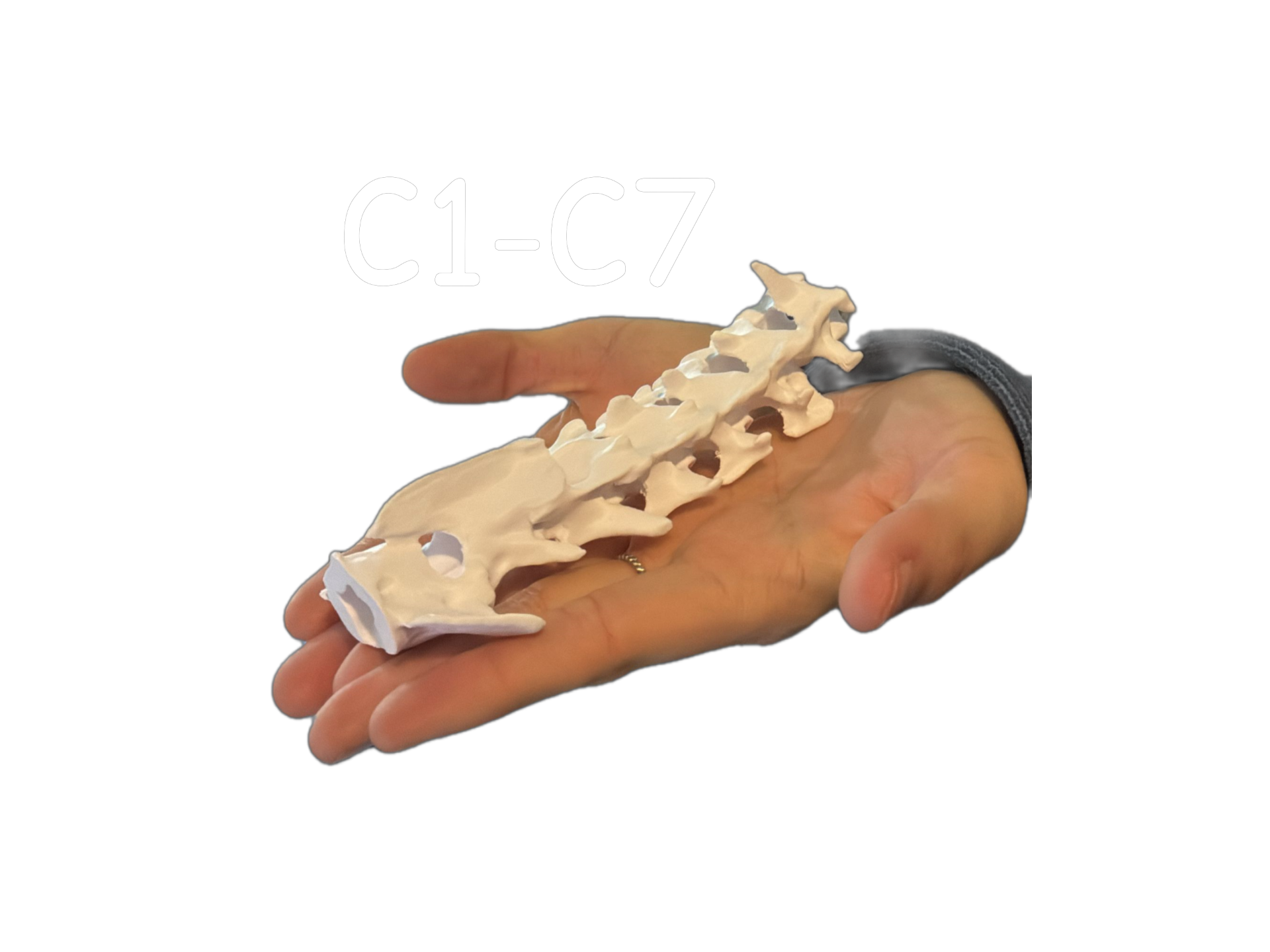 Teckel Cervicales Perro TAC - CT Scan C1-C7