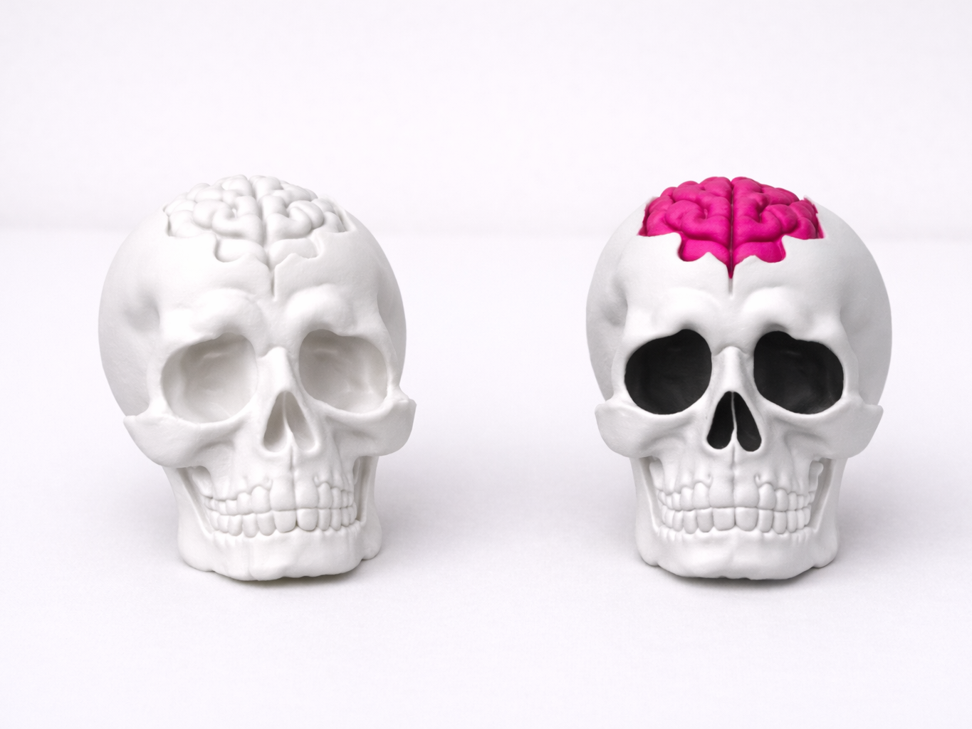 Skull with Brain
