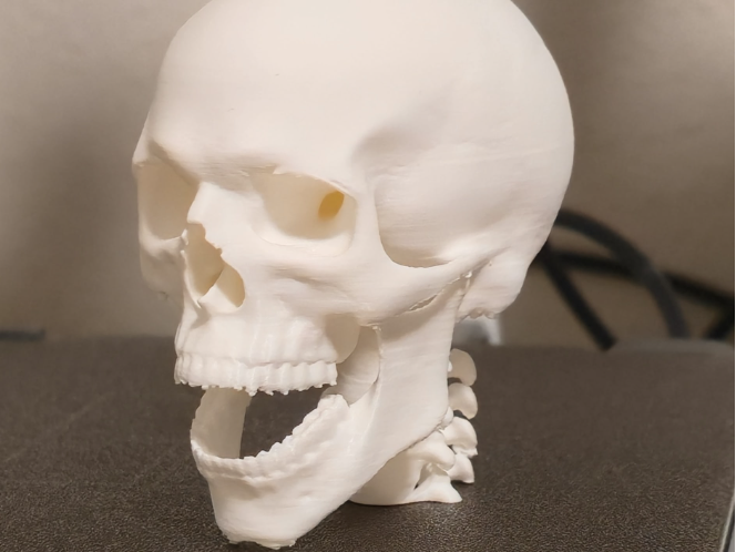 screaming skull