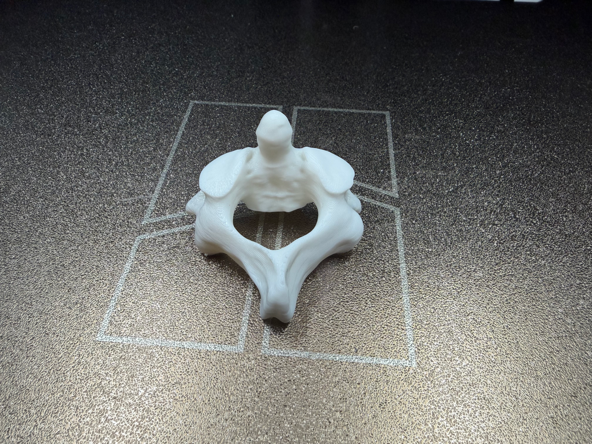 C2 (Axis) Human Vertebra Anatomically Correct