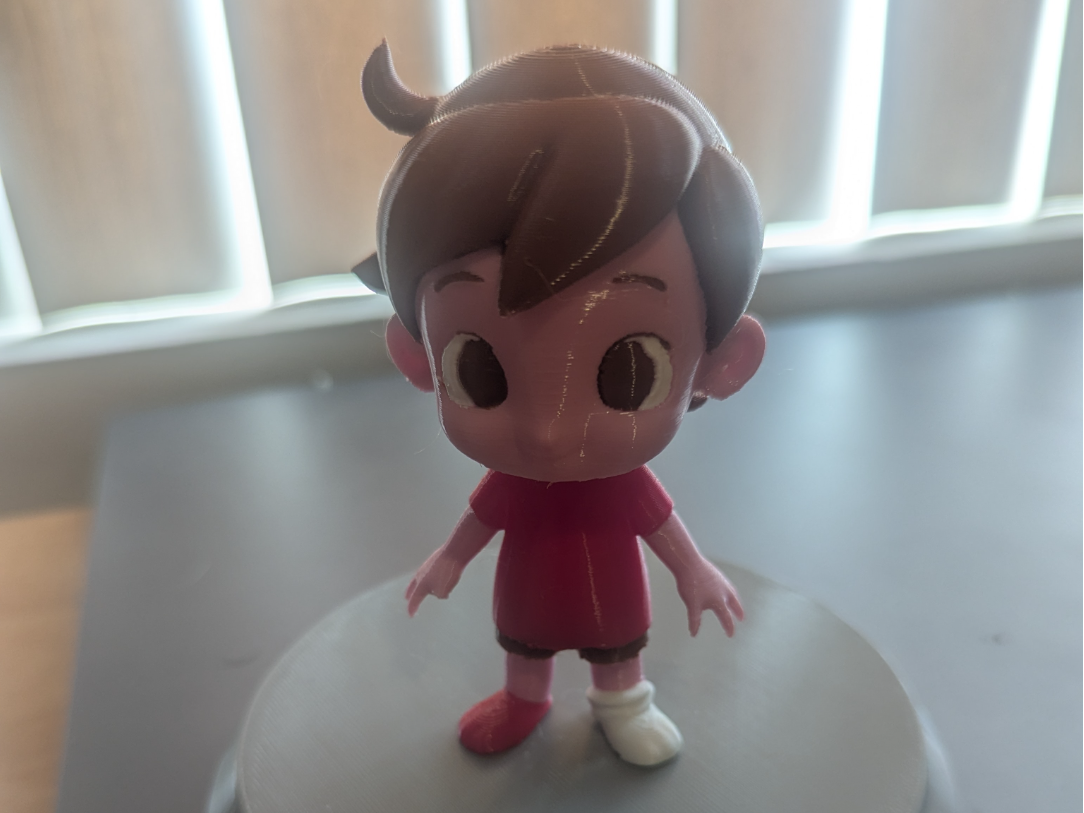 Kid with Broken Leg Cast (4-5 Color)