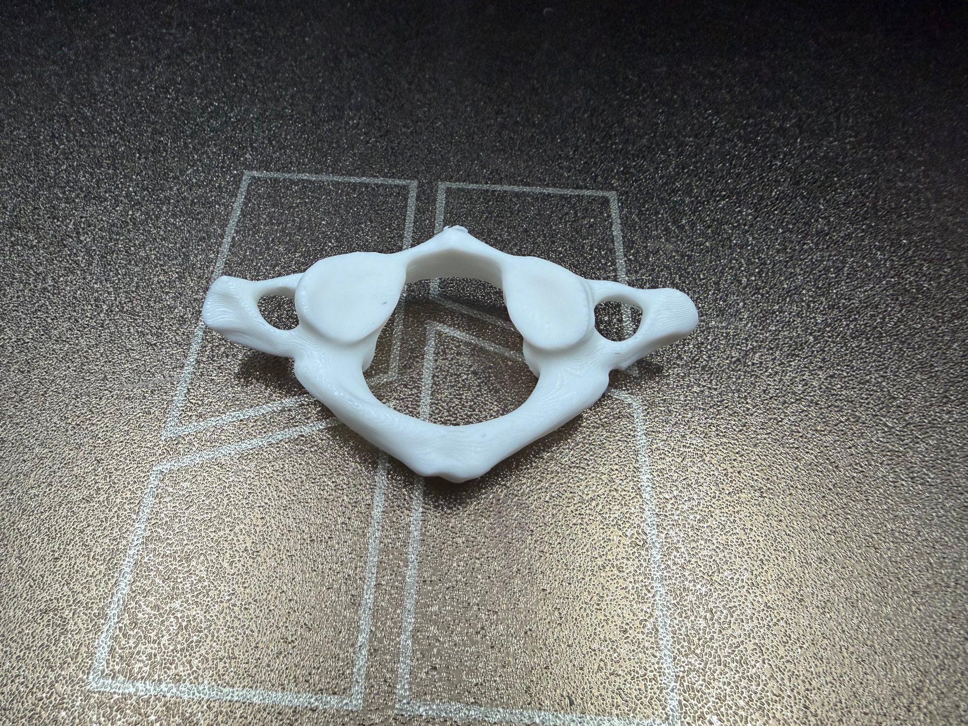 C1 (Atlas) Human Vertebra Anatomically Correct