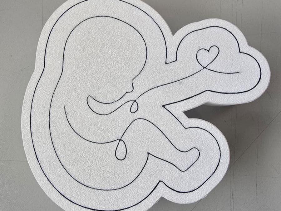 Umbilical Cord Keepsake Box