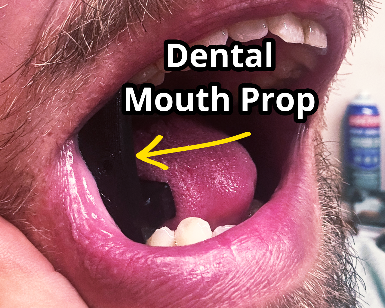 Dental Mouth Prop. Dental work bite guard