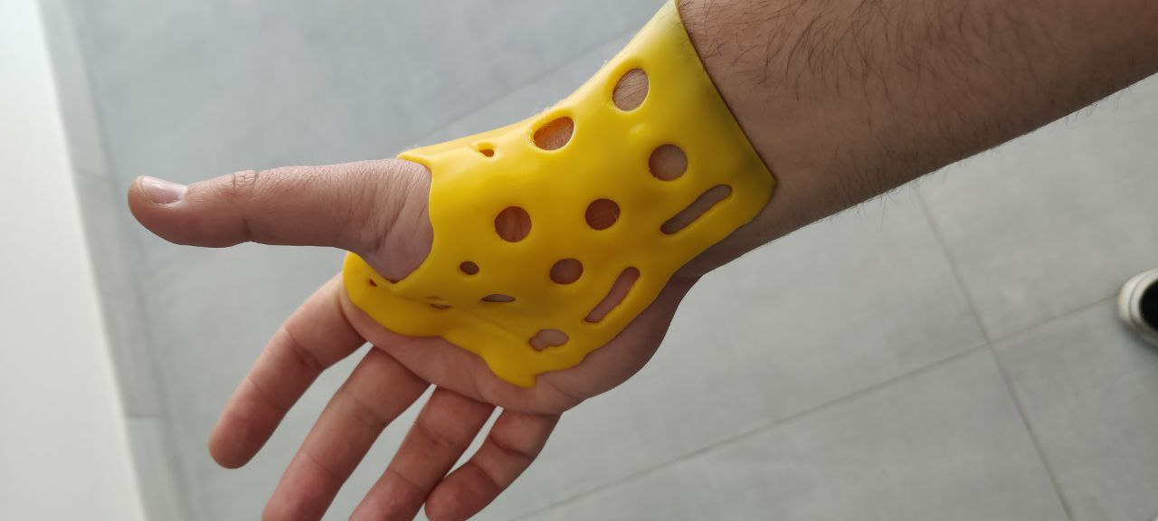 Wrist brace_V2