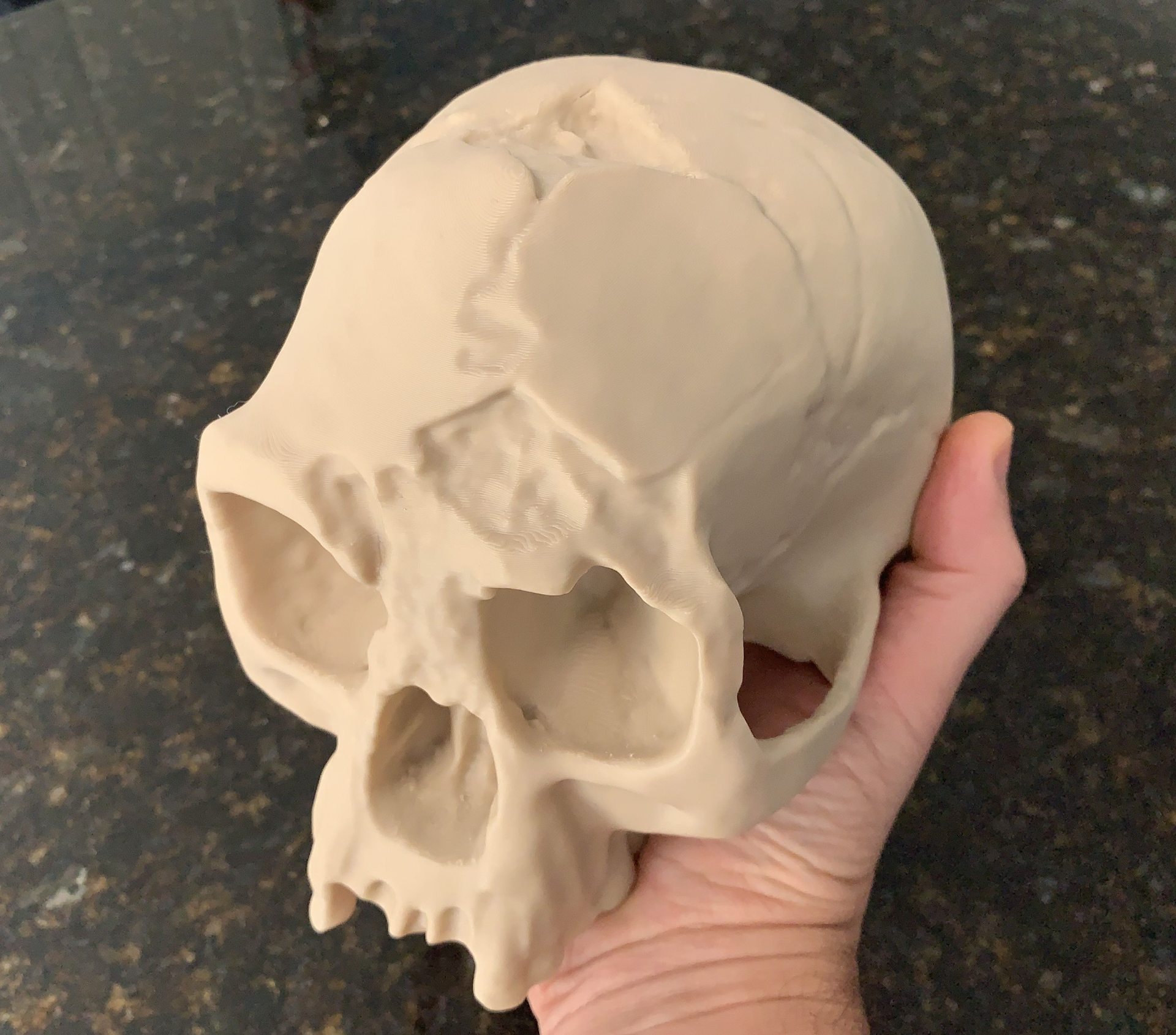 Homo Floresiensis Cranium (The Hobbit)