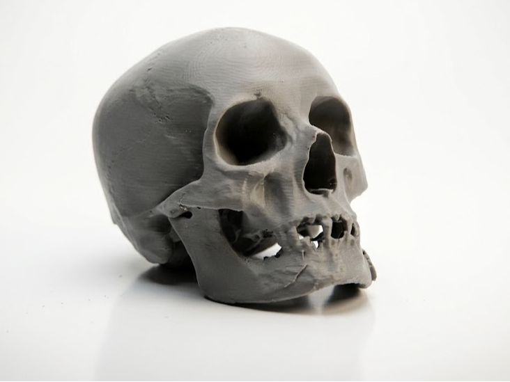 Skull